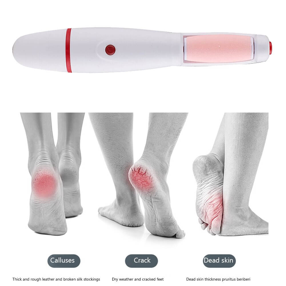 SmoothFeet Pro – Lima Eléctrica de Precisión