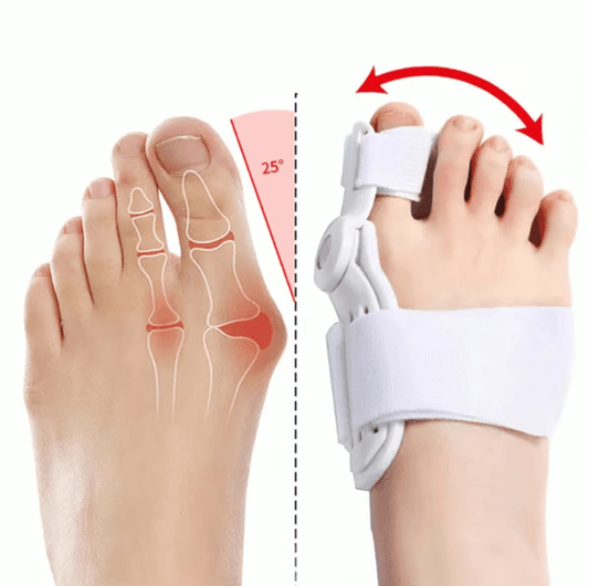 🎁 MEGA PROMO 2x1 🎁 Corrector De Juanetes Ergonómico de Alta Eficiencia