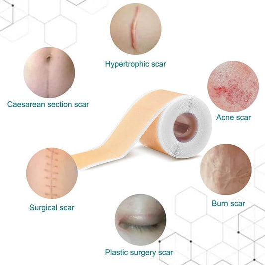 SilkScar™ - Parche de Silicona para Cicatrices
