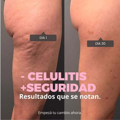 FirmGlow™: Gel Anti Celulitis Reafirmante